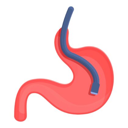 胃カメラ検査